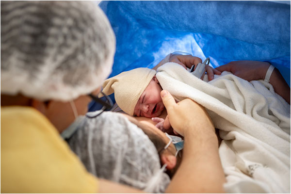 Cesarean Birth