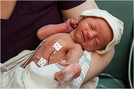 Neonatal Intensive Care (NICU)